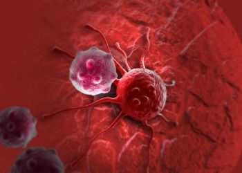 What Are the Causes and Symptoms of Bone Cancer? - Oren Zarif.