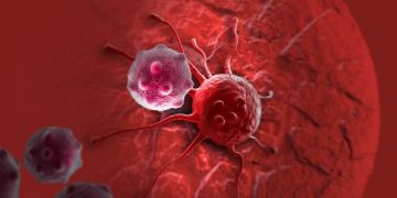 What Are the Causes and Symptoms of Bone Cancer? - Oren Zarif.