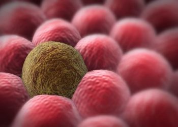 Liver Cancer Overview - Oren Zarif