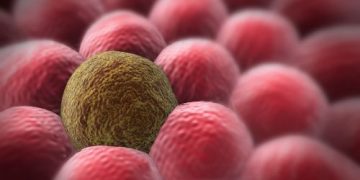 Liver Cancer Overview - Oren Zarif