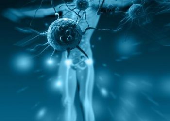 Alcohol Abuse And Liver Cancer - Do They Go Together? - Oren Zarif