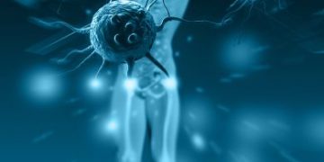 Alcohol Abuse And Liver Cancer - Do They Go Together? - Oren Zarif