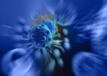 Liver Cancer - The Importance of Recognizing the Symptoms - Oren Zarif