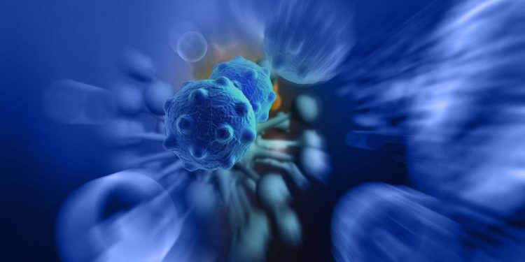 Liver Cancer - The Importance of Recognizing the Symptoms - Oren Zarif