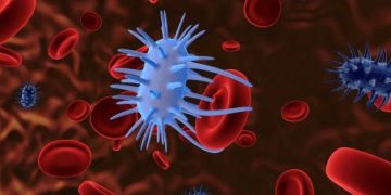 Symptoms of Pancreatic Cancer - Oren Zarif