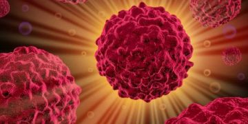 Pancreatic Cancer and Your Relative Survival Rate - Oren Zarif