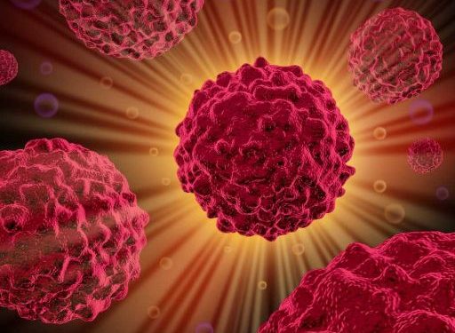 Pancreatic Cancer and Your Relative Survival Rate - Oren Zarif
