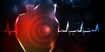 Stroke Symptoms. - Oren Zarif