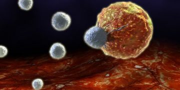 Find Out the Most Common Types of Cancers and Their Symptoms - Oren Zarif