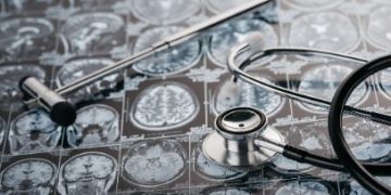 Symptoms of Ischemic Stroke - Oren Zarif