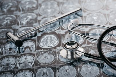 Symptoms of Ischemic Stroke - Oren Zarif