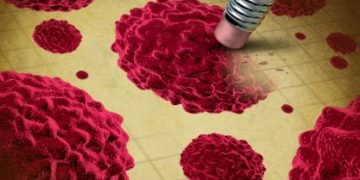 Identifying the Most Common Types of Cancer in Adolescents - Oren Zarif