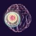 Stroke Symptoms - Oren Zarif