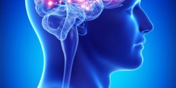 Stroke Symptoms in Women - Oren Zarif