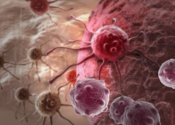 Common Types of Cancer That Affect Adults - Oren Zarif