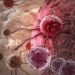 Common Types of Cancer That Affect Adults - Oren Zarif