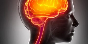 Stroke Symptoms - What Are They? - Oren Zarif