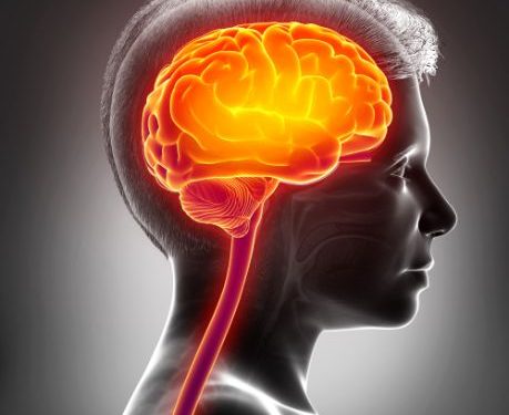 Stroke Symptoms - What Are They? - Oren Zarif