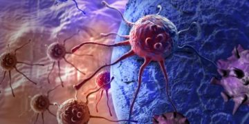 Types of Cancers That Can Affect Older Adults - Oren Zarif