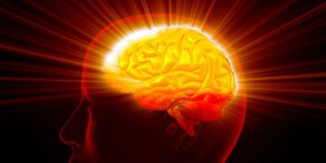 Warning Signs of a Stroke - Oren Zarif