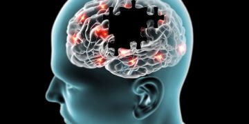 Stroke Symptoms That Can Lead to a Permanent Damage - Oren Zarif