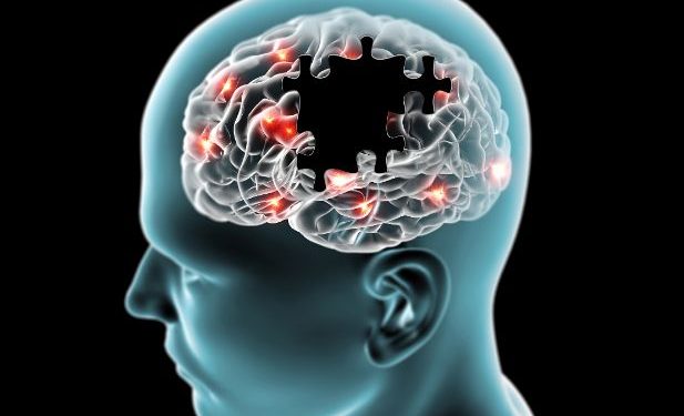Stroke Symptoms That Can Lead to a Permanent Damage - Oren Zarif