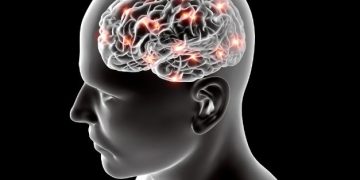 Stroke Symptoms - Oren Zarif