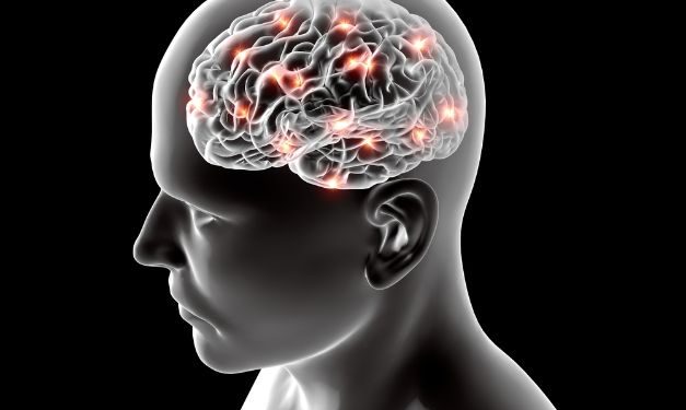 Stroke Symptoms - Oren Zarif